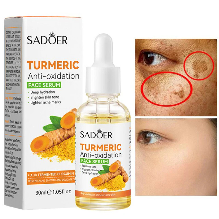سرم ضد لک سادور SADOER ANTI OXIDATION SERUM